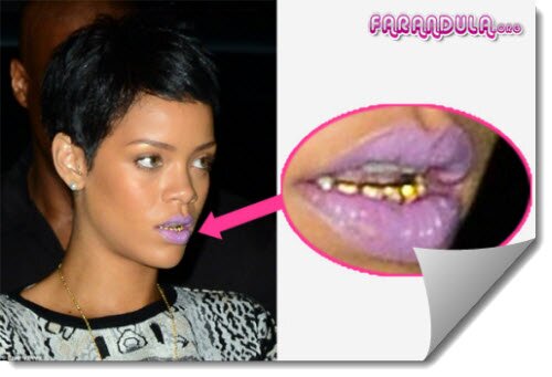 Rihanna luce dientes de oro